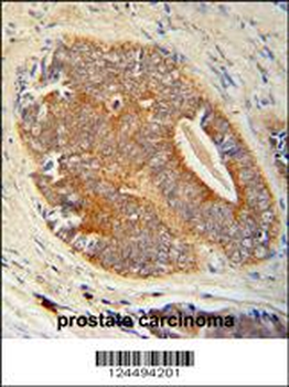 GAGE7 Antibody (C-term)
