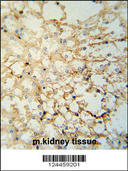LYPD1 Antibody (C-term)