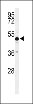 ANKH Antibody (C-term)