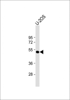 ANKH Antibody (C-term)