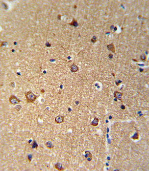 ANKH Antibody (C-term)