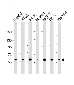 DCLRE1C Antibody (N-term)