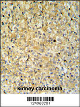 MAPK1IP1L Antibody (Center)