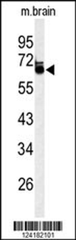 LRRTM1 Antibody (Center)