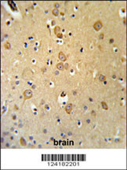 LRRTM1 Antibody (Center)