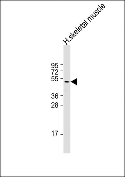 ZDHHC9 Antibody (C-term)