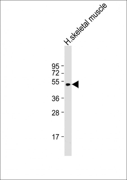 ZDHHC9 Antibody (C-term)