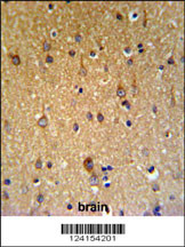 ZDHHC9 Antibody (C-term)