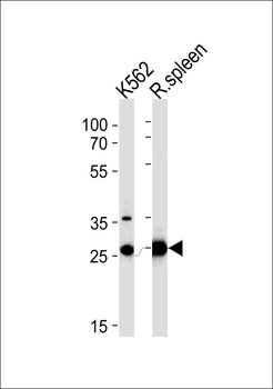 SLC25A37 Antibody (C-term)