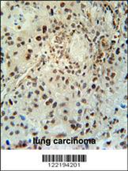 ABHEB Antibody (C-term)