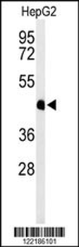 HFE2 Antibody (C-term)
