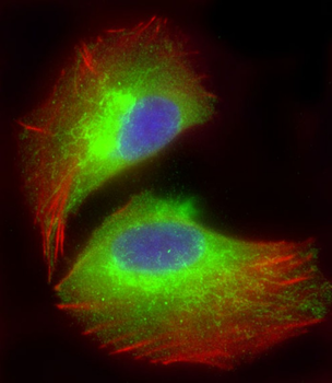 COXI Antibody (Center)