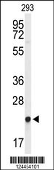GGCT Antibody (C-term)