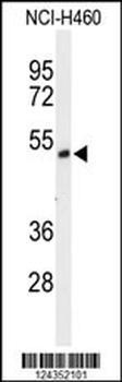 FXRD1 Antibody (C-term)