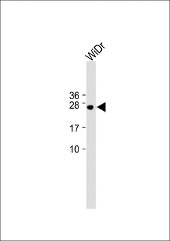 NMRK1 Antibody (N-term)
