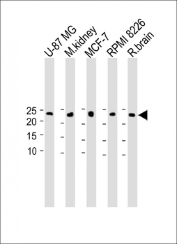 NMRK1 Antibody (N-term)