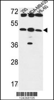 B3GNT5 Antibody (Center)