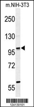 ZNF451 Antibody (N-term)