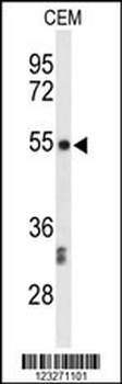 CENPI Antibody (Center)