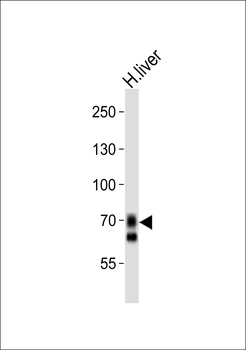 SLCO1B1 Antibody (Center)