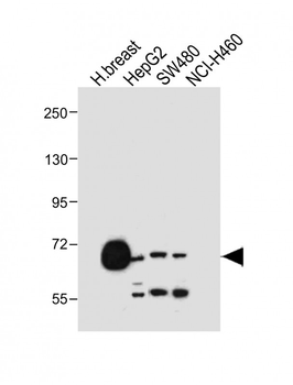 SLCO1B1 Antibody (Center)
