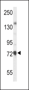 CHAT Antibody (N-term)