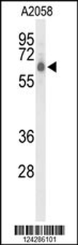 CLPTM1L Antibody (C-term)