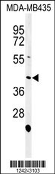 NOXA1 Antibody (C-term)