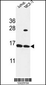 SPRR1A Antibody (C-term)