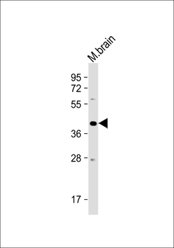 PSG3 Antibody (N-term)