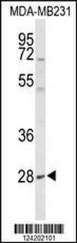 YIPF5 Antibody (N-term)
