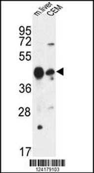 PLA1A Antibody (Center)