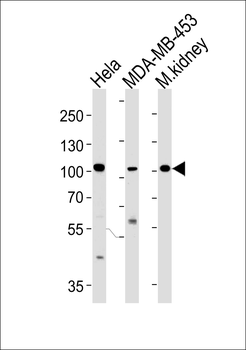 NCOA7 Antibody (N-term)