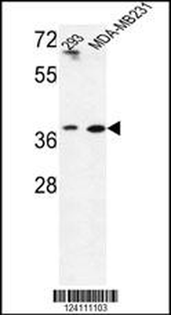 MAT2B Antibody (N-term)