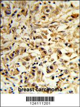 MAT2B Antibody (N-term)