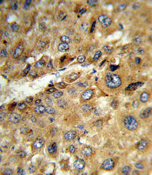 TAT Antibody (Center)