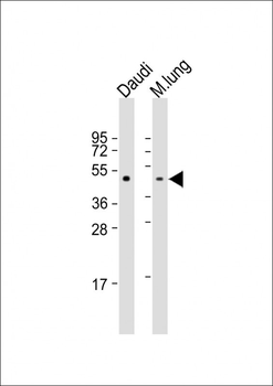 TAT Antibody (Center)