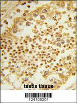 RPL31 Antibody (Center)