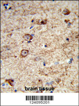 LRRC4 Antibody (C-term)