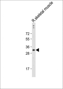 DIO3 Antibody (C-term)