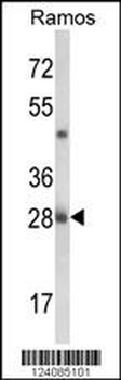 NUCKS1 Antibody (N-term)