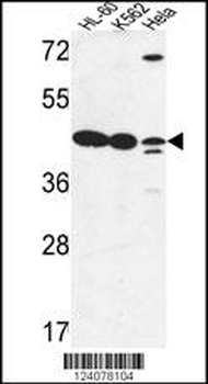 LFNG Antibody (Center)