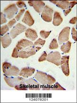 LFNG Antibody (Center)