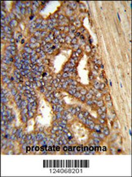 AMY1A Antibody (Center)