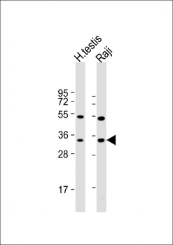 HSD17B3 Antibody (Center)