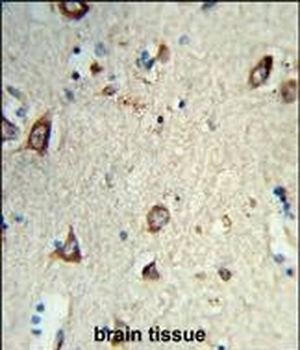 HS3ST2 Antibody (C-term)