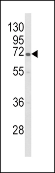 GBE1 Antibody (Center)