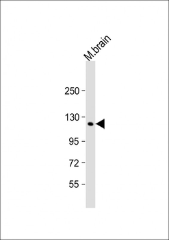 C11orf30 Antibody (N-term)