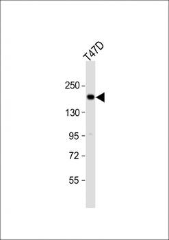 PREX1 Antibody (Center)