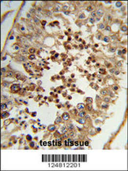 TAC2N Antibody (N-term)